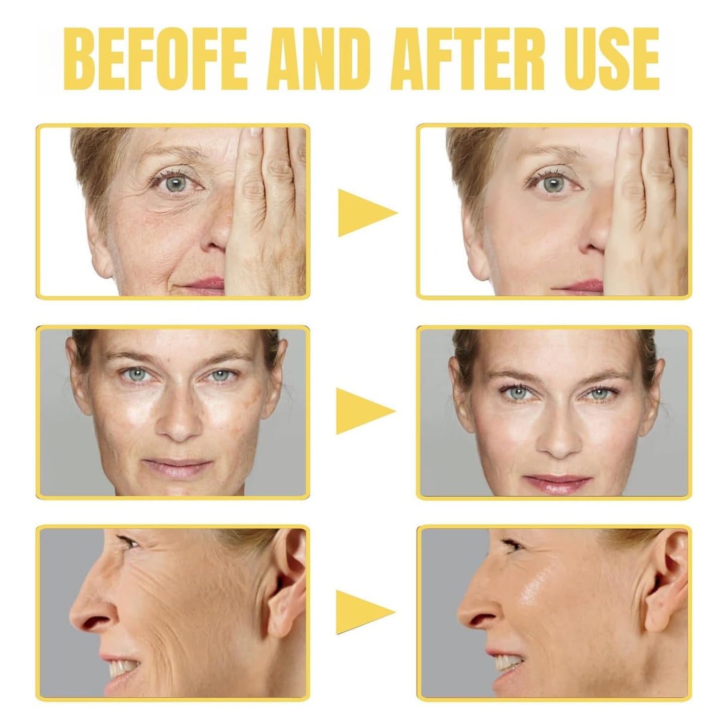 Generic Frankincense Resin Oil for Face - Organic Botanical Extract for Skin, Deeply Hydrates and Softens, Lightweight Feel, Non-Greasy Formula, Supports Radiant Complexion, Facial Nourishing Oil, 30ML