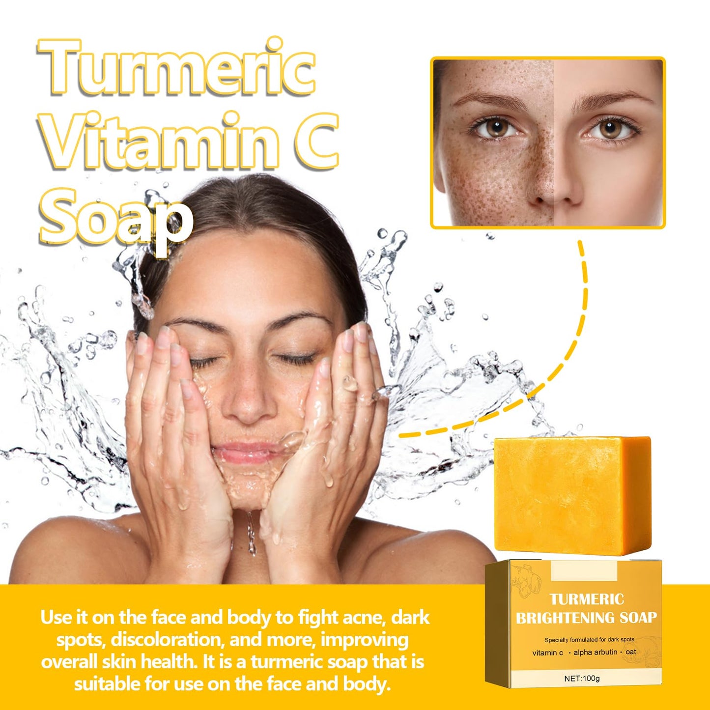 Cynamus Turmeric Soap, 100g Kojic Acid Soap For Skin Brightening Bath Soap Brightening Moisturizing Deep Clean Ginger Soap, Turmeric Soap For Acne And Dark Stains
