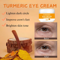 IZBEAUVO Turmeric Skincare Set,Face Skin Care Sets include Turmeric Soap Bar,Face cream,Eye cream,Neck cream,Anti-Aging Skin Care Set,Moisturizing,Acne Dark Spot Remover,Moisturizing Erase Fine Lines,Firming