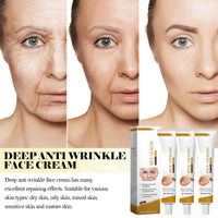 SingHao 3PCS Bee Venom Wrinkle Removal Cream,Bee Ven/om Anti-Wrinkle Cre/am,An/ti Wrin/kle Firming Multi Purpose Cr/eam,Anti Wrink/le Face Moisturizer,Be/e Ve/nom Skin Treatment Cream,Moisturizer C/ream