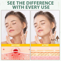 ThamGlow Beef Tallow for Skin Care, Tallow and Honey Balm, Tallow Face Cream, Tallow Face Moisturizer, Organic Grass-Fed Whipped Tallow Balm