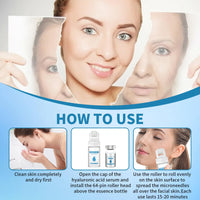 Leogony 5 PCS Serum Micro Infusion Facial System with Roller, Micro Infusion Facial System for Lips for Repair Skin Deep Nourishmen