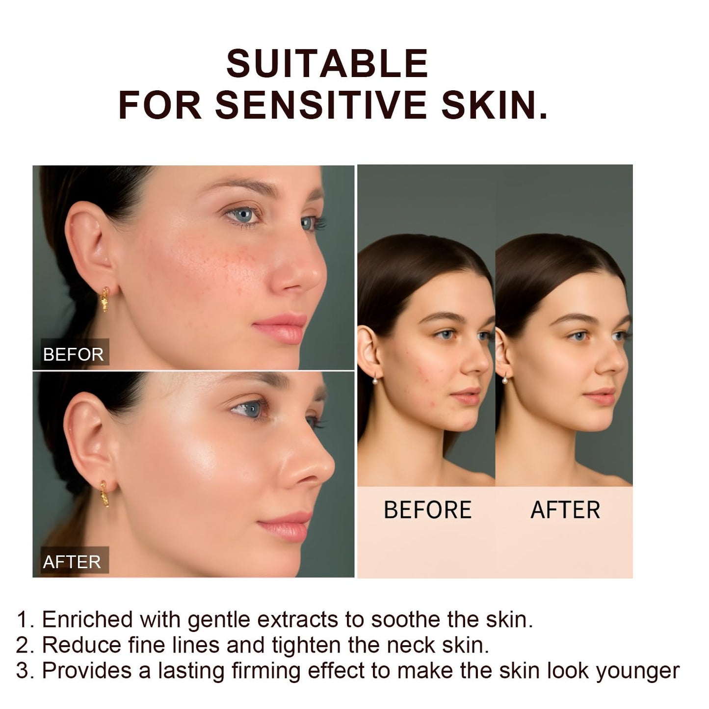 100g Jorondy Firming Cream, 2025 New Advanced Skin Firming Cream, Anti Wrinkle, Tightening and Lifting, Improves skin Sagging, Smooths Wrinkles and Fine Lines
