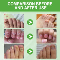 2PCS Radiant Nail Growth Oil,Cuticle Oil for Nail,Cuticle Nail O/il,Radiant Nail Growth Oi/l Pen,Nail Growth O/il,Cuticle Moisturizer & Nail Strengthener,Finger Edge Manicure Nourishing Pen
