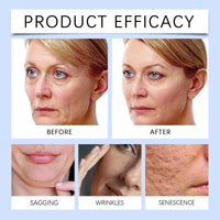 Oumun Wrinkle Removal Cream,Anti Wrinkle Face Cream,Face Cream,Tightening Anti-Wrinkle Cre-am,Erase Lines and Wrinkles,Moisturiser Face Women,Instant Face Lift Cre-am for All Skin