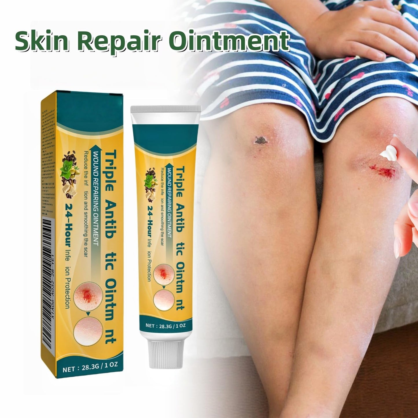 OuXing Wound Healing Oint-Ment,Relieve Skin Abrasions,Natral Healing Cream,Promote Skin HEA/ling Cream,Scab He/aling Cr/eam,Wo/und Cre/am Fade Scars,Wo/und He/aling Crea/m,Body Cre/am,WOU/nd Protection