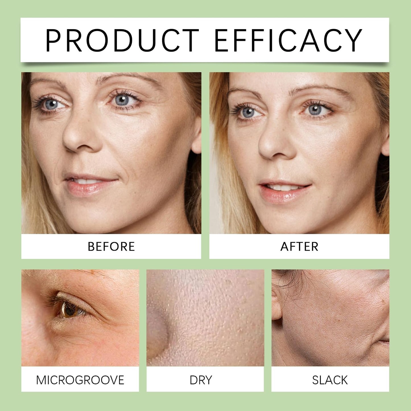 SingHao 50ml Dark Spot Correcting Glow Serum with 5% Niacinamide,Nicotinamide Facial S/erum,Hydrating & Brightening Ser/um,Niacinamide Dark S/pot Remover for Face,Dark Spot Se/rum with Hyaluronic Acid