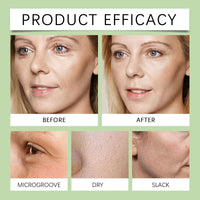 SingHao 50ml Dark Spot Correcting Glow Serum with 5% Niacinamide,Nicotinamide Facial S/erum,Hydrating & Brightening Ser/um,Niacinamide Dark S/pot Remover for Face,Dark Spot Se/rum with Hyaluronic Acid