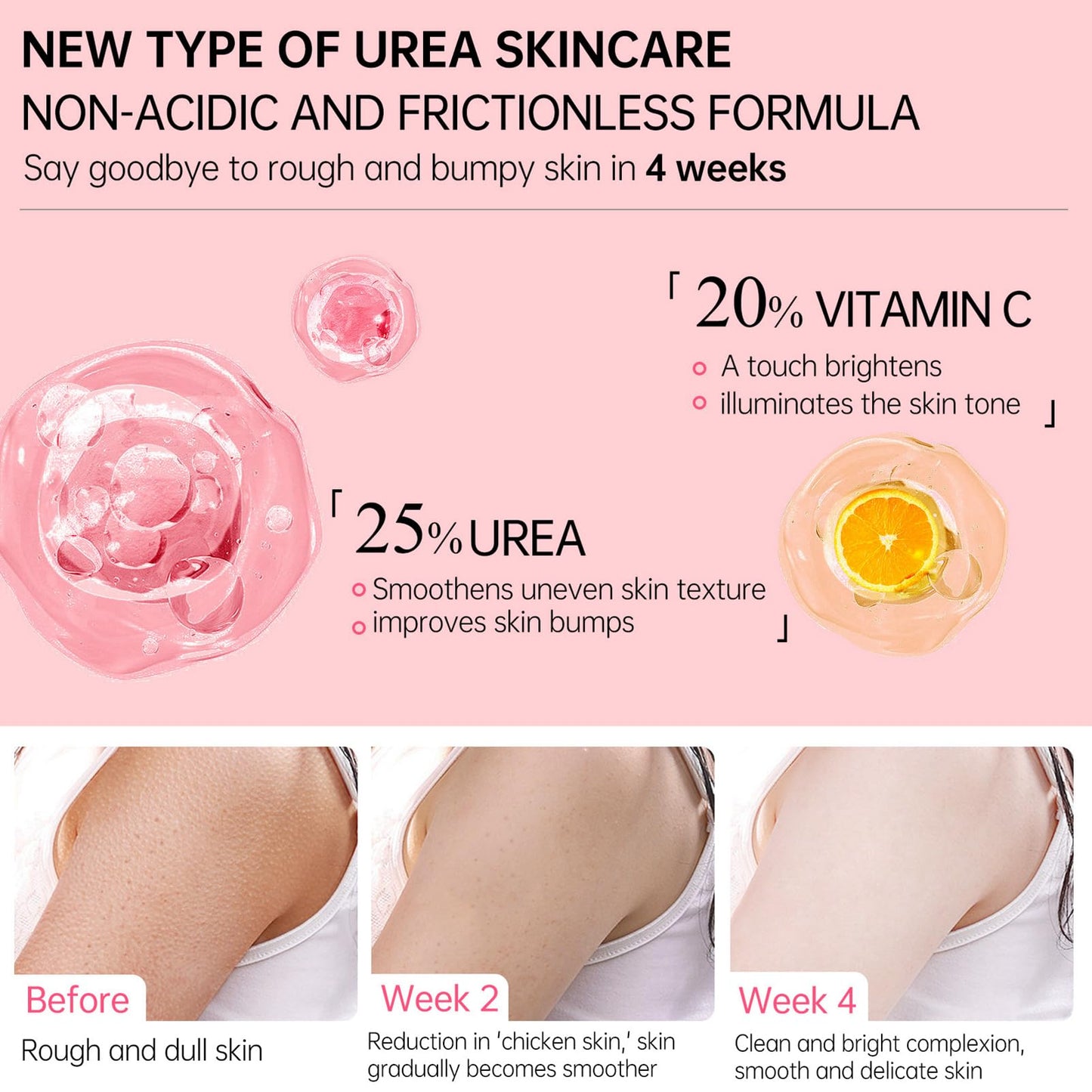 MEITREND Strawberry Skin Treatment,Skin Exfoliating Repair Cream with 20% Vitamin C and 25% Urea,Strawberry Legs Treatment Rough Bumpy Skin Body Lotion Moisturizing Cream,Chicken Skin Care Cream