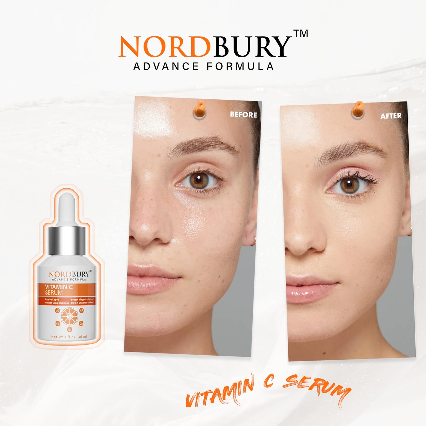 NORDBURY Nordbury Vitamin C Serum, Pure 20% Vitamin C with Vitamin E & Hyaluronic Acid for Face Day & Night, Brighten Skin Complexion Boost Collagen Production Fade Dark Spots Protects Skin from Radicals