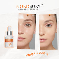 NORDBURY Nordbury Vitamin C Serum, Pure 20% Vitamin C with Vitamin E & Hyaluronic Acid for Face Day & Night, Brighten Skin Complexion Boost Collagen Production Fade Dark Spots Protects Skin from Radicals