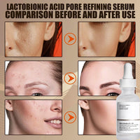 GNAUMORE Hyaluronic Acid 2% + B5,Hyaluronic Acid For Face Hydrated,Hyaluronic Acid Serum for Face,Dark Spot Remover for Face,Skincare Serum,Lightweight Face Serum 30ML