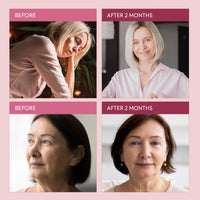Menopause Face Cream for Women: Nourishing Moisturizer for Menopausal Skin - 3-Month Supply