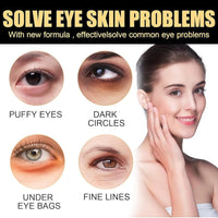 Fankayi Rollerball Castor Oil,Eyelid Lifting Cream,Eye Cream for Dark Circles and Puffy Eyes,Eyes Roller for Dark Circles and Puffiness,Eye Serum for Lines and Wrinkles,A Cure for Darkness