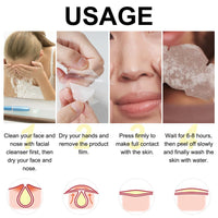SHEBEEDO 12Pcs Hydrocolloid Nose Strips,Blackhead Remover Strips,Nose Pore Strips for Unclog and Shrink Pores,Absorbs Oil,Removal Acne,Pimple,Zits,Spot,Targets Pores & Pimples