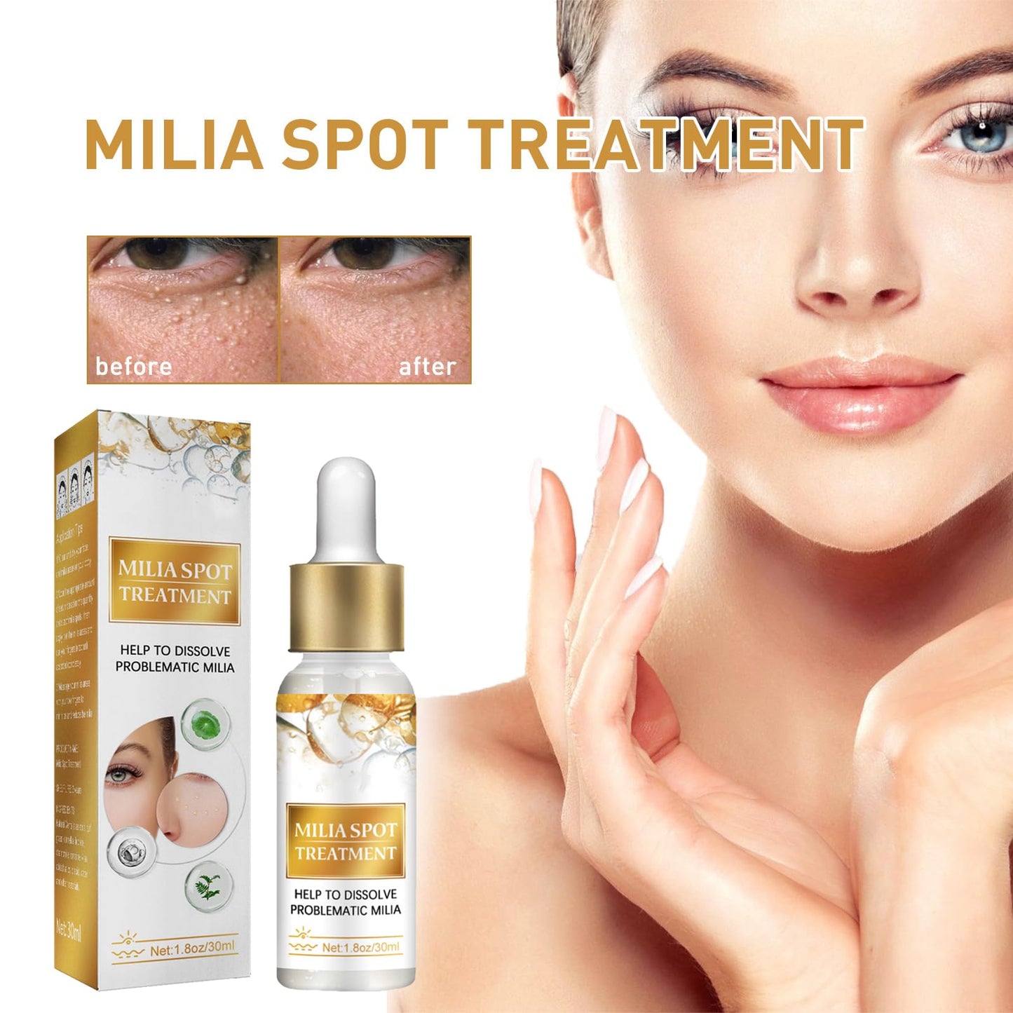 GNAUMORE Milia Spot Serum for Face,Milia Treatment under Eye,Eye Serum for Dark Circles and Puffy Eyes,Fat Granule Clearing Skin Serums,Even and Radiant Skin Generic,30ml