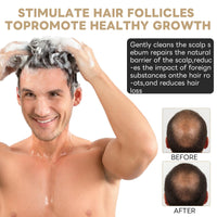 GMHLLES Hair Loss Shampoo Set Mane Root Activator Shampoo for Men Anti-Hair Loss,with nourishing Conditioner+foaming Net,Mane for Men Unisex