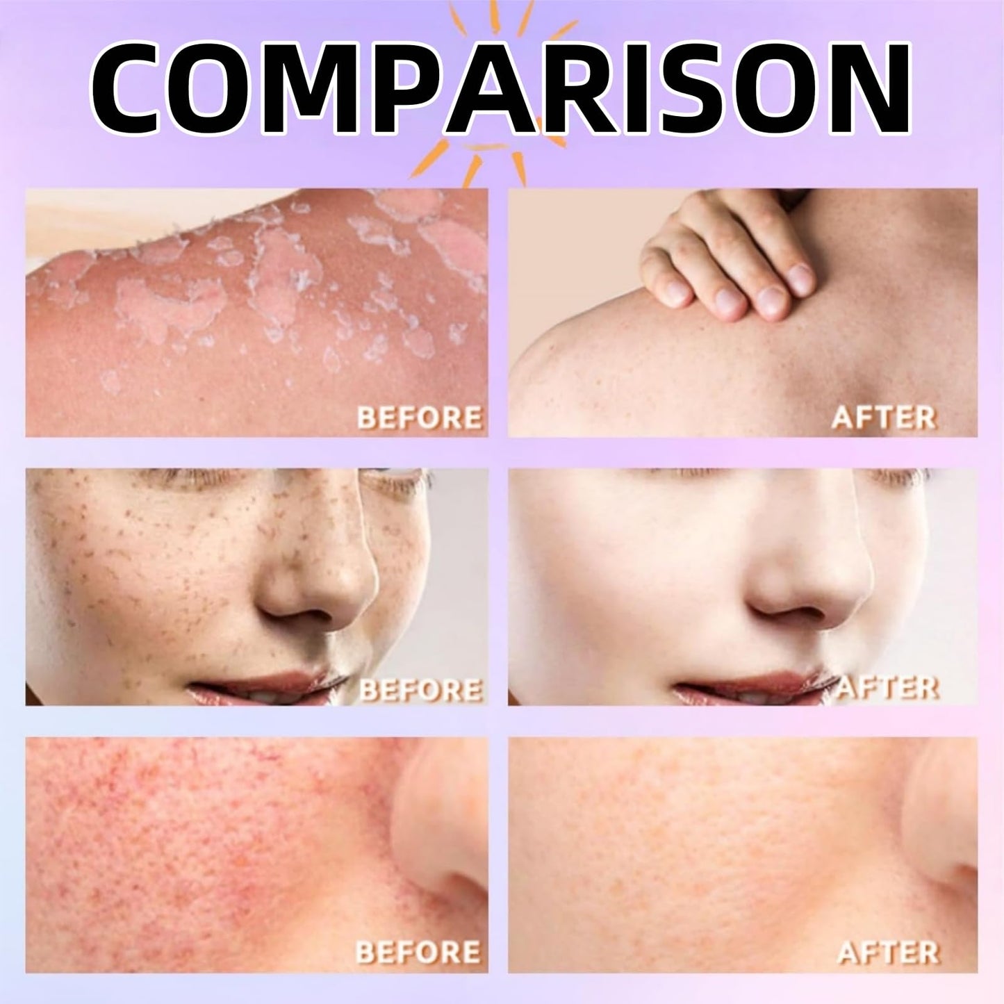 Yoowan Spf 100 Sunscreen,Sun Cream Spf 100,High Factor Sun Cream Sp-F 100,Pa+++,Light Uv Protetion Sunscreen For Face&Body,Long-Lasting Hydration,Water And Sweat Resistant,Refreshing,Non Greasy&Non Sticky