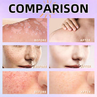 Yoowan Spf 100 Sunscreen,Sun Cream Spf 100,High Factor Sun Cream Sp-F 100,Pa+++,Light Uv Protetion Sunscreen For Face&Body,Long-Lasting Hydration,Water And Sweat Resistant,Refreshing,Non Greasy&Non Sticky