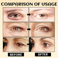 MEITREND Under Eye Bags Cream,2PCS Eye Bags Within Minutes,Instant Firming Eye Cream for Wrinkle,Turmeric Retinol Eye Cream Stick,Anti Aging Eye Cream Stick,Reduce Dark Circle and Puffy Eye,Hydrating Eye Serum