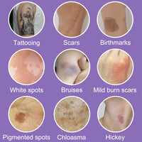 NLFOX All over Complexion Perfector - Body Coverage Perfector Waterproof - Tattoo Cover up Makeup - Body Concealer Full Coverage - Body Foundation Colour Corrector for Legs and Body, 60g