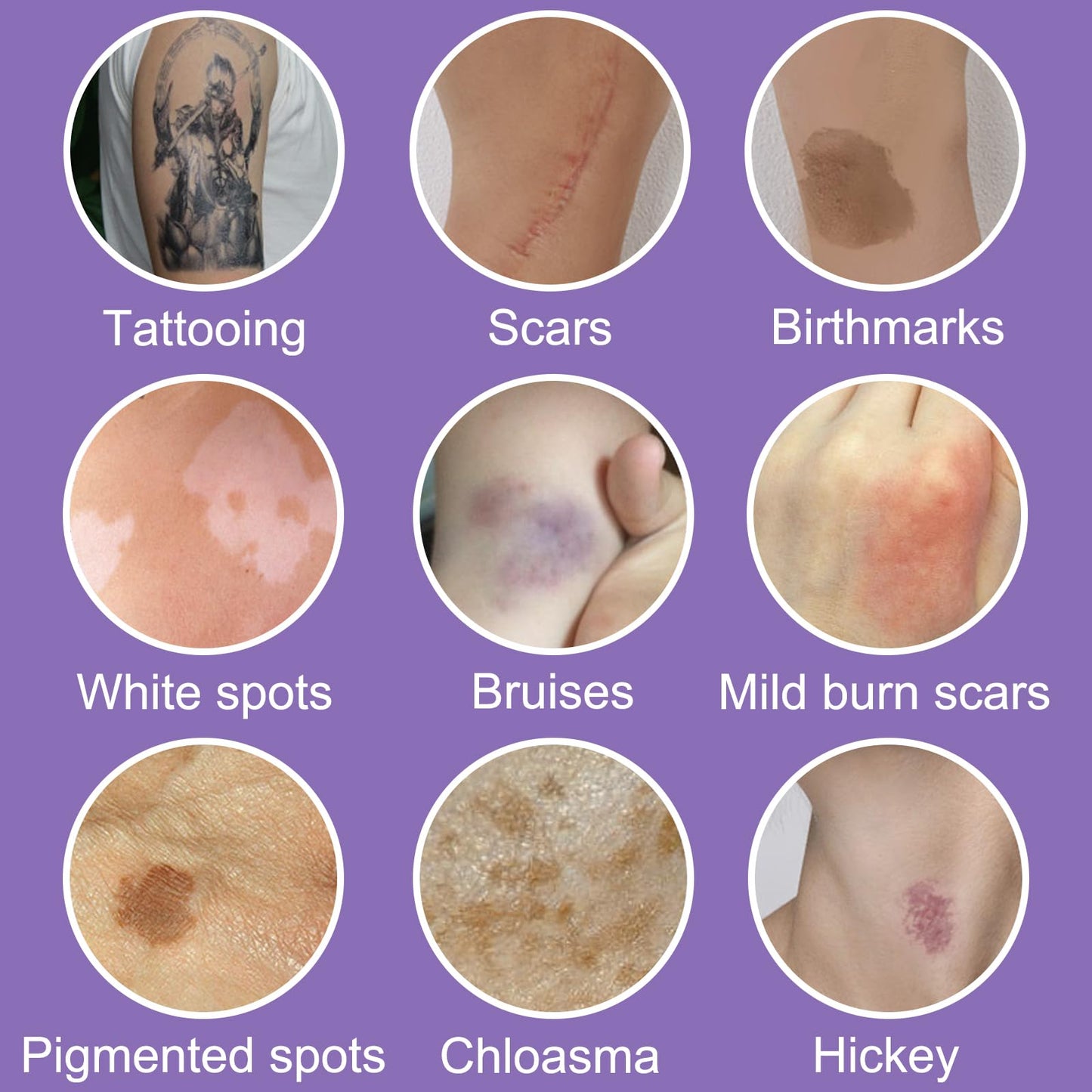 NLFOX Body Coverage Perfector - Waterproof Body Concealer Complexion Perfector - Full Coverage Tattoo Cover up Makeup with Brush - Long Lasting Body Foundation Natural for Legs, Body