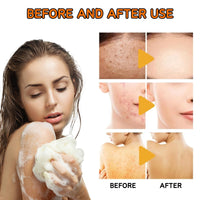 ISBEAUSOLS Turmeric Soap Bar for Women - Turmeric & Kojic Acid Soap - Natural Soap - Tumeric Soap,Acne,Dark Spots,Hyperpigmentation, Smooth Skin - Turmeric & Kojic Acid Bar Shop - 100g*3PCS