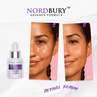 NORDBURY Retinol Serum, 2.5% Retinol with Vitamin E Ceramide Hyaluronic Acid & Organic Aloe Vera, Smooth Fine Lines Reduce Wrinkles and Improve Texture Skin Renewal Actively Night & Day