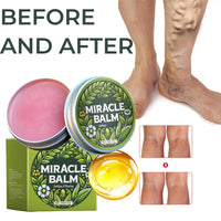 SingHao Miracle Balm,Miracle Soothing Cream,Muscle Pain Relief Cream,Herbal Balm for Legs,Moisturizing Pain Relief Crea/m,Fast Absorbing Body Cre/am,Targeted Pain Relief for Muscles,Fast Acting&Gentle