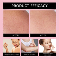 Fankayi Optimal Oil,Stretch Mark & Scar Treatment Skincare Oil,Stretch Mark & Scar Treatment Skincare O/il,Optimal O/il for Collagen Boosting and Lifting Skin/care,Firming Lifting Skin/care O/il,Moisturizing