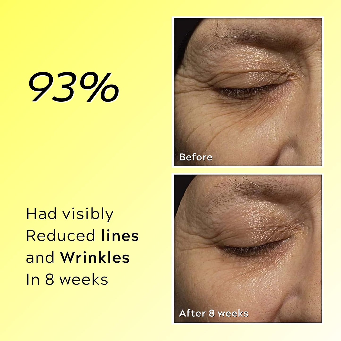 TBeautfave Retinal Shot Tightening Booster, Retinol Cream, Retinol Serum for Face Moisturiser, Retinol Night Cream for Women Anti Aging, Wrinkles & Fine Lines, Firmer Skin, Skin Renewal, 15ml