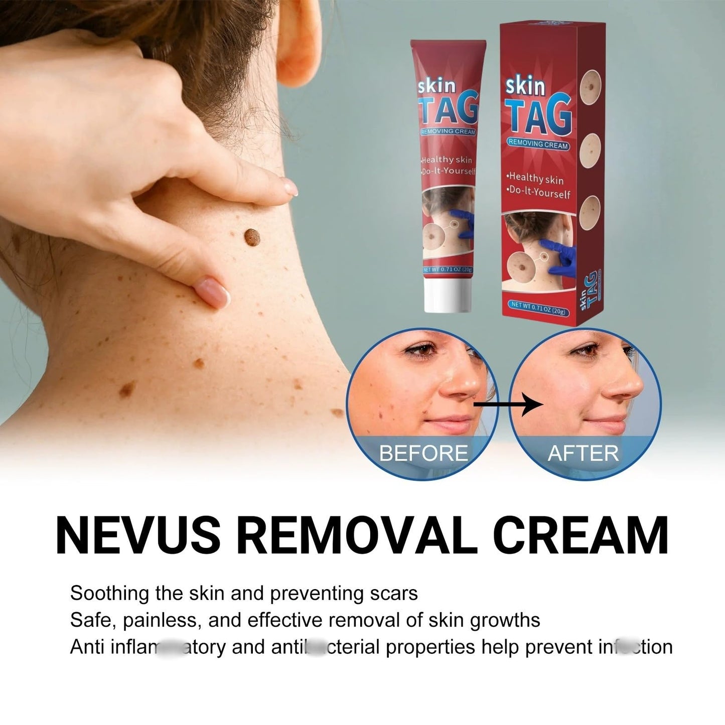 Wart Remover Cream,Effective Wart Removal,Mole Remover,Fast Effective Safe Skin Mole Removal,Wart Treatment for Face & Hands & Body,Wart Remover for Hands,Wart Re-Mover for Face,Flat Wa-rt Remover