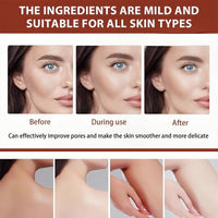 Purifying Exfoliating Gel for Women, Exfoliating Gel Face Scrub, Gentle Peeling Exfoliator, Softens Dead Skin, Cleansing & Moisturizing Facial Care