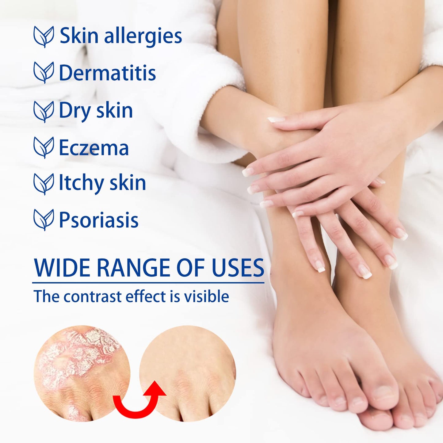 Herbal Skin Relief Cream with Aloe Vera – Soothing Moisturizer for Dry Skin – Lightweight, Non-Greasy Daily Hydration for All Types(2pcs) (2PCS)