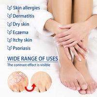 Herbal Skin Relief Cream with Aloe Vera – Soothing Moisturizer for Dry Skin – Lightweight, Non-Greasy Daily Hydration for All Types(2pcs) (2PCS)