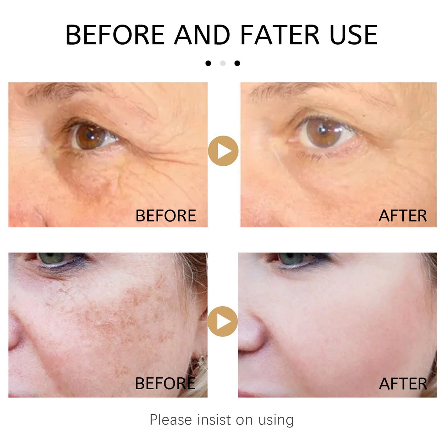 NatrLuxe Vitamin C & Turmeric Face Serum For Aging & Wrinkles - Oil With 20% Vitamin C, Improves Dark Spots & Fine Lines, Moisturizing Skin Care Formula