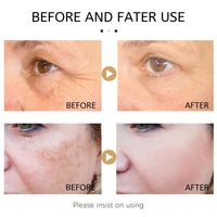 NatrLuxe Vitamin C & Turmeric Face Serum For Aging & Wrinkles - Oil With 20% Vitamin C, Improves Dark Spots & Fine Lines, Moisturizing Skin Care Formula
