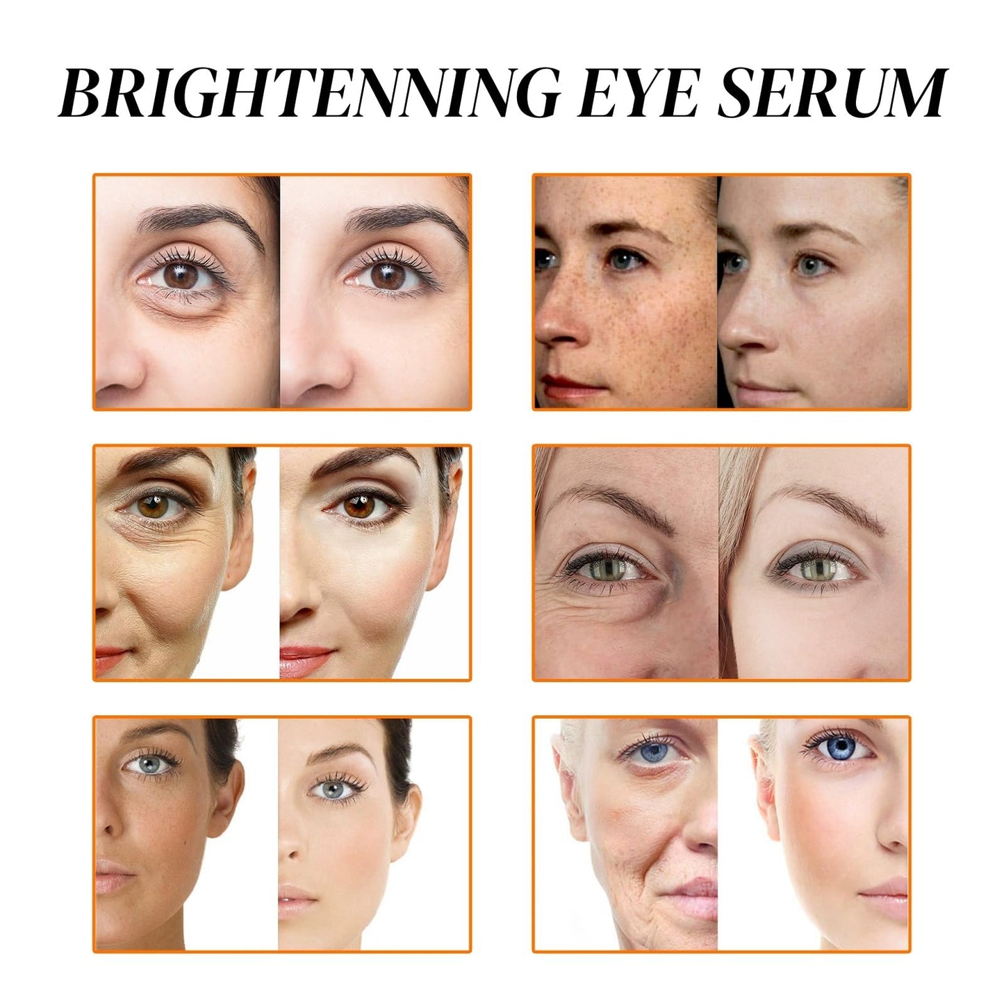 OuXing Spot Correcting Glow Serum,Hydrating & Brightening Serum,Spot Remover for Face,Skin Repairing Face Serum,Spot Treatment,Skin Lightening Cream,Freckle Removal Cre/am,Fa/ce Seru/m for Women,Sp/ot Cre/am