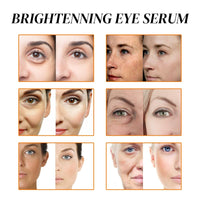 OuXing Spot Correcting Glow Serum,Hydrating & Brightening Serum,Spot Remover for Face,Skin Repairing Face Serum,Spot Treatment,Skin Lightening Cream,Freckle Removal Cre/am,Fa/ce Seru/m for Women,Sp/ot Cre/am