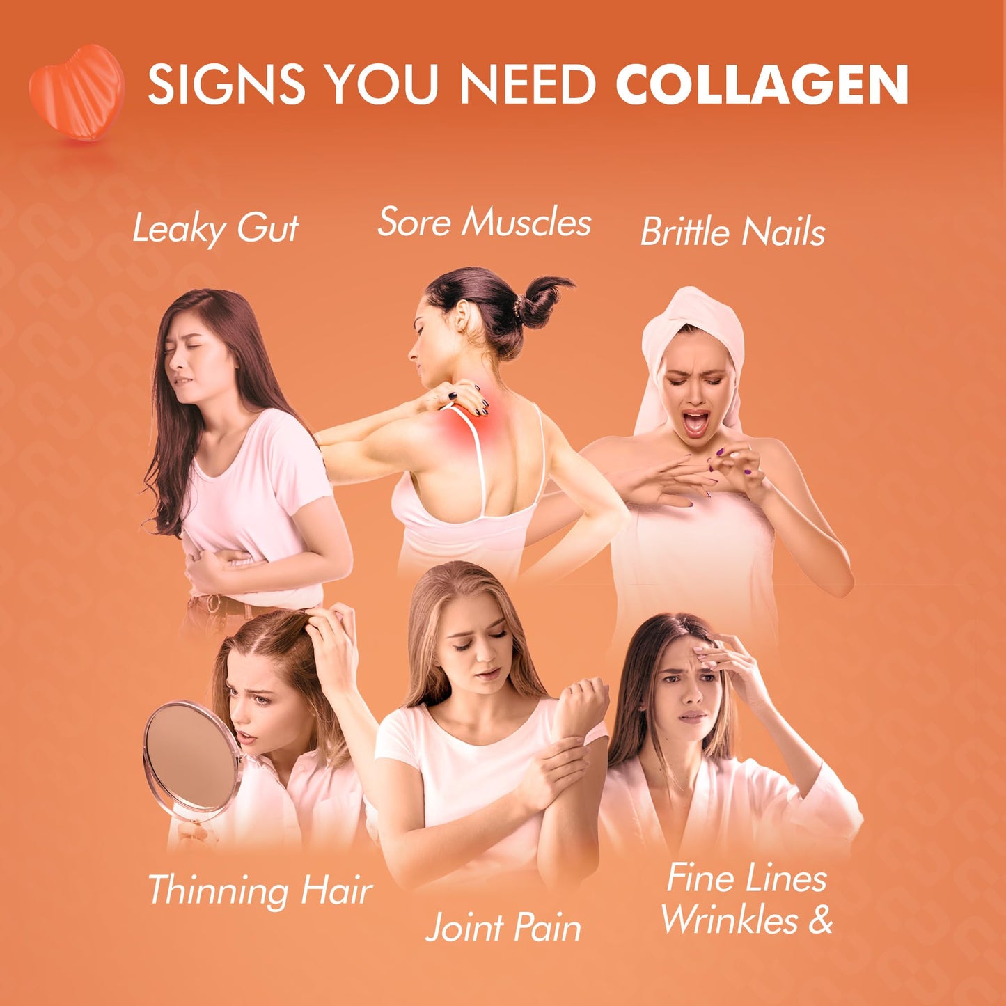 supplmnt. Marine Collagen Gummies - Hydrolysed Collagen Peptides with Biotin, Hyaluronic Acid & Vitamin C - Collagen Supplements for Women and Men - 120 Gummies. Collagen for Skin, Hair & Nails 2 Months Supply