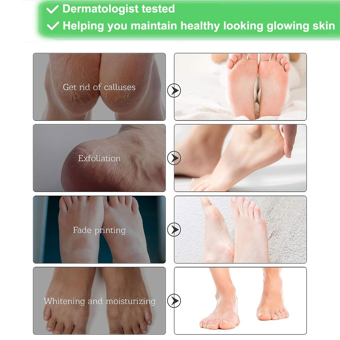 HOKIAMCN 3 Pairs Foot Peel Mask,Foot Exfoliating Mask Socks Calluses Remover Dead Skin, Moisturizing Feet Peeling Mask for Dry Skin,Cracked Heels,Foot SPA Socks for Women and Men (Rose Extract)