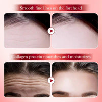 Cureluxe Forehead Wrinkle Patches