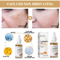Turmeric Serum Dark Spot Removal, Ksndurn Turmeric Face Serums Oil, Turmeric Dark Spot Corrector Serum for Face & Body, Heals Scars, Moisturizing, Skin Brightening Serum for Dark Spots