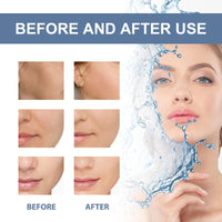 Siyinzu 4PCS Deep Collagen Retinol Tension Boost up Mask,Retinol Collagen Lifting Mask,V-Line Lifting and Face Tightening Ma-sk,Bio Collagen Ma-sk Overnight,Deep Moisturizing Colla-gen Face M-ask for Women