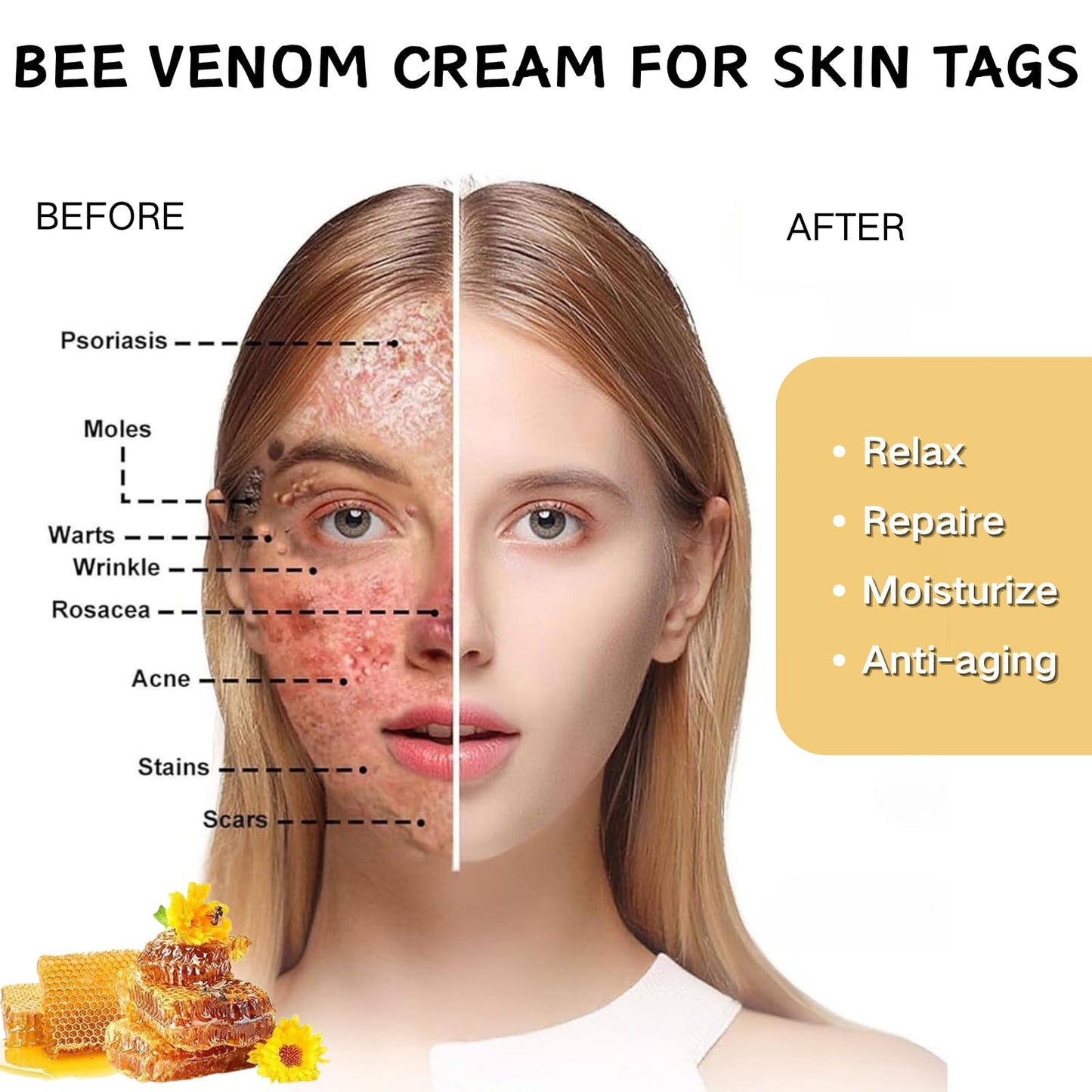 IZBEAUVO Bee Venom All-in-One Cream, BeeVenom SkinTreatmentCream with Allantoin & Mint | Lightweight Non-Greasy Formula | Improves Skin Texture & Skin mole Remover | Bee Venom Cream for All Skin Types | 60g