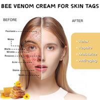 IZBEAUVO Bee Venom All-in-One Cream, BeeVenom SkinTreatmentCream with Allantoin & Mint | Lightweight Non-Greasy Formula | Improves Skin Texture & Skin mole Remover | Bee Venom Cream for All Skin Types | 60g