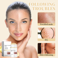 Benaewa Melanin Correcting Cream, Dark Spot Remover for Body, Moisturizing Skincare Cream