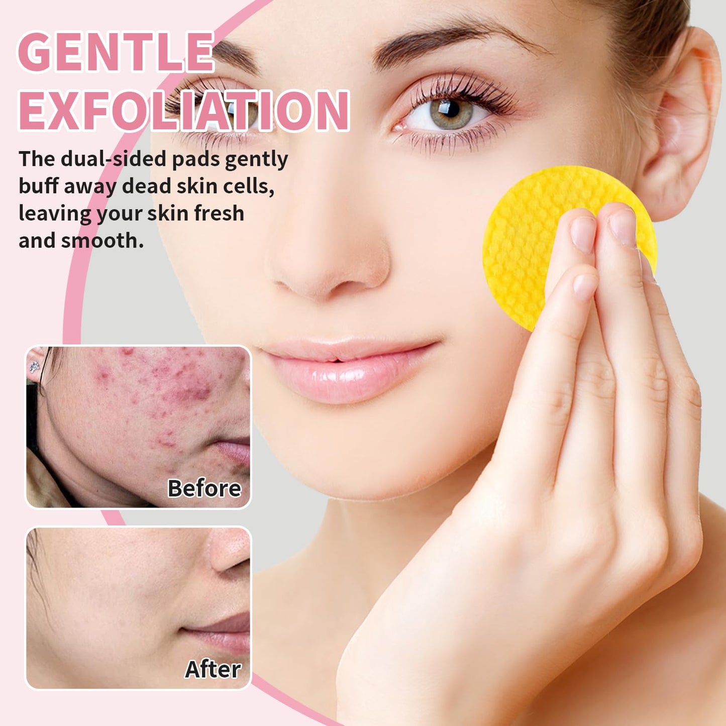 Benaewa 120Pcs Kojic Acid and Turmeric Pads for Women, Turmeric Cleansing Pads for Dark Spots