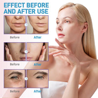 7Pcs Hyaluronic Acid Micr-oneedling Serum,Hyaluronic Acid Concentrated Ampoules,Hyaluronic Acid Serum for Face Micr-oneedling Serum,Hyaluronic Acid Micr-oneedling Serum,Hydrating Face Serum for Women
