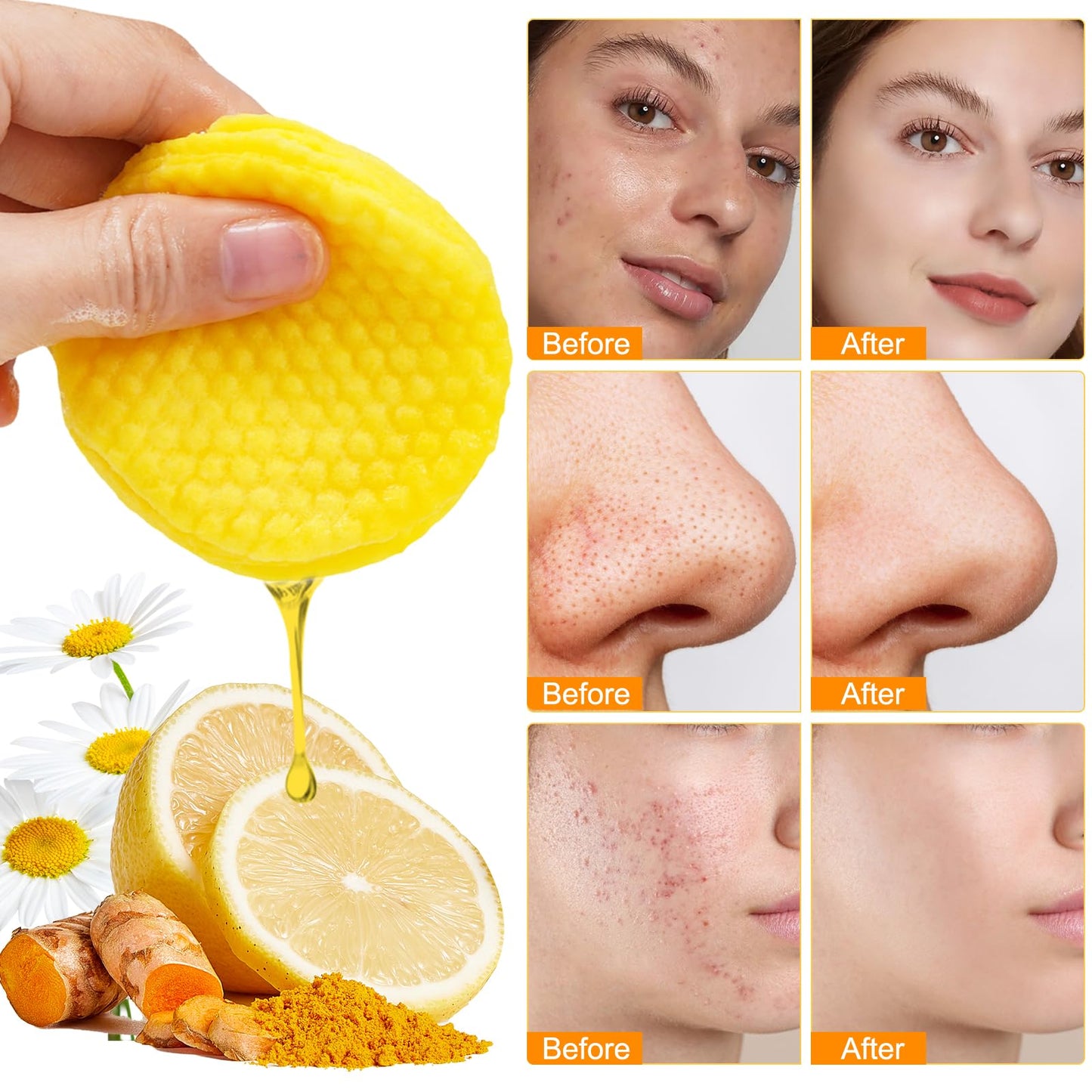 Kojic Acid and Turmeric Pads,Turmeric kojic Acid Pads for Face, Turmeric and Kojic Acid Cleansing Pads,Turmeric Cleansing Pads for Dark spots, Exfoliating, Acne Scars (30 PCS)